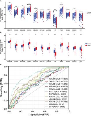 Jumonji domain-containing protein RIOX2 is overexpressed and associated with worse survival outcomes in prostate cancers